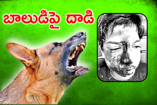 street-dog-attacked-a-boy-playing-in-front-of-the-house-in-medchal-malkajgiri