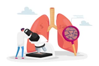 tuberculosis symptoms diagnosis and treatment