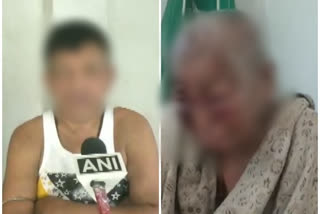 BJP worker's mother died after allegedly beaten by Tmc wokers in Nimta