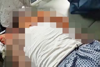 कोटा न्यूज  kota news  केमिलकर पिलाने का मामला  एमबीएस अस्पताल  MBS Hospital Kota  Case of drinking