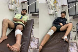 two miscreants arrested and got injured while the encounter