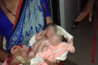 Woman gives birth to baby with two heads, three hands in Odisha