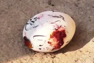 மாந்திரீக முட்டை  மாந்திரீக முட்டையால் இளம்பெண் உயிரிழப்பு  மாந்திரீகம் செய்யப்பட்ட முட்டை  Magical egg  Young Women Died By Magical Egg  Young Women Died By Magical Egg in thiruvallur