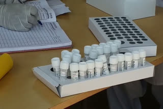 lab of raigarh stopped taking samples from jashpur