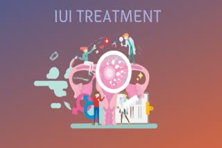 IUI, IUI and IVF, fertility treatment