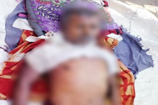 the-man-died-in-palamu-while-undergoing-treatment