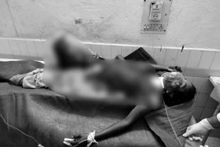 husband killed wife in vijayanagaram