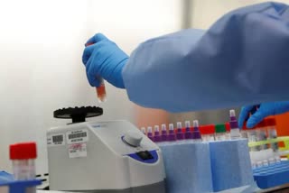 ആര്‍.ടി.പി.സി.ആര്‍. പരിശോധനാ നിരക്ക്  RTPCR testing rate  covid test  കൊവിഡ് പരിശോധന