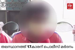 തലസ്ഥാനത്ത് പൊലീസ് മർദനം  17കാരനായ വിദ്യാർഥിക്ക് നേരെ പൊലീസ് മർദനംട  മാറനല്ലൂരിൽ പൊലീസ് മർദനം  മറനല്ലൂരിൽ 17 കാരന് മർദനം  Police harassment in POLICE BEATEN MINOR BOY IN CAPITAL CITY KERALA  police beaten student in Thiruvananthapuram  maranallor boy beaten by police news  minor boy beaten by police news