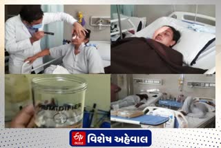 ઓક્સિજન આપતી વખતે સ્ટરાઈલ વોટરની જગ્યાએ સાધારણ પાણીનો વપરાશ પણ મ્યુકોરમાયકોસિસ થવા પાછળનું કારણ