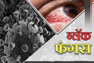 Jalgaon mucormycosis news