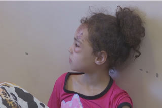 Gaza girl pulled from rubble traumatised by ordeal