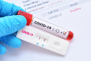 home based covid testing kit  icmr has approved a home based testing kit for covid  ICMR nod to use home based covid testing kit  icmr latest news  ICMR approved home-based RAT kit  ഗാർഹിക റാപ്പിഡ് ആന്‍റിജൻ പരിശോധന കിറ്റ്  ഐസിഎംആർ അനുമതി നൽകി  റാപ്പിഡ് ആന്‍റിജൻ പരിശോധന കിറ്റ്  മൈലാബ്‌ ഡിസ്‌കവറി സെലൂഷൻസ് നിർമിച്ച കിറ്റ്  മൈലാബ്‌ ഡിസ്‌കവറി സെലൂഷൻസ്  റാപ്പിഡ് ആന്‍റിജൻ പരിശോധന