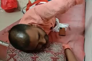 a man injured in firing in ballia