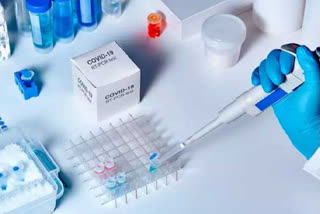 Cipla launches RT-PCR test kit name