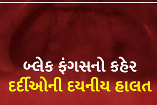 મ્યુકોરમાઇકોસિસના દર્દીઓની દયનીય હાલત, દાંત સાથે આખું જડબું પણ કાઢવું પડી શકે છે