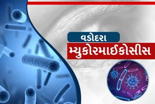 વડોદરામાં મ્યુકોરમાઈકોસિસના નવા 12 કેસ નોંધાયા