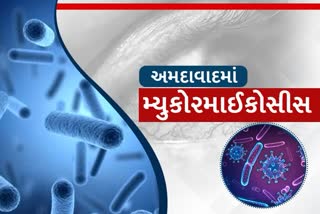 13 વર્ષીય બાળકને થયો મ્યુકોર માયકોસીસ