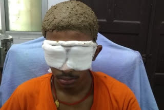 black fungus patient eye operation in agroha medical college hisar