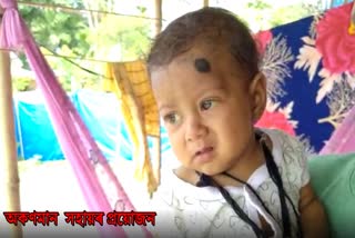 A baby of Sonari needs help