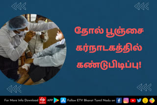 கருப்பு, வெள்ளை, மஞ்சள் அடுத்து புதிதாக வந்தது தோல் பூஞ்சை