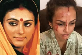 seeing-the-wound-on-nisha-rawal-face-dipika-chikhila-said-the-marks-are-telling-the-truth