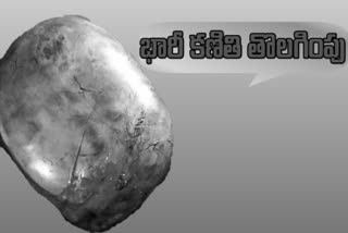 Tumor Surgery: మహిళ కడుపులో నుంచి 20 కిలోల కణతి తొలగింపు