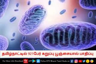 921-person-infected-mucormycosis-in-tamilnadu