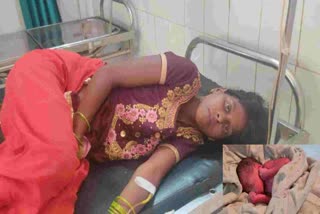 woman-gave-birth-to-child-on-road-in-garhwa