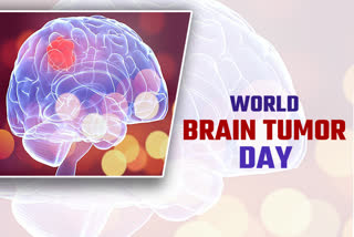 Know what is brain tumor on World Brain Tumor Day