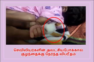 பிறந்த குழந்தையின் கட்டை விரல் துண்டிப்பு ?