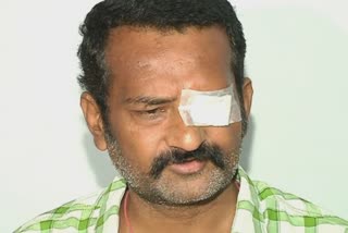 નાગપુરમાં મ્યુકરમાઈકોસિસના દર્દીએ સારવારમાં દોઢ કરોડ ખર્ચા છતાં આંખ ગુમાવવી પડી