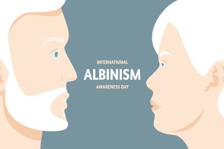 international-albinism-awareness-day-2021-strength-beyond-all-odds