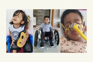 Three year old Ayansh got new life after beat spinal muscular atrophy