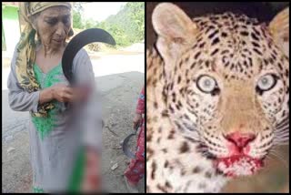 leopard-attack-on-old-woman