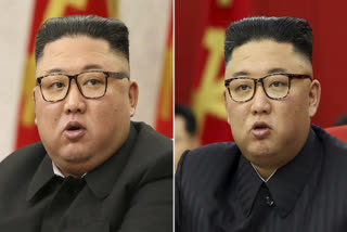 N Korea's Kim looks much thinner, causing health speculation