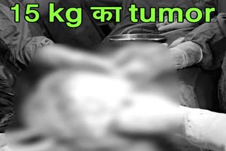 15 kg tumor removed in rohtas