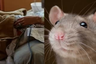 Patient bitten by rat