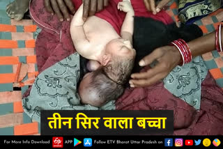 three-headed child in mainpuri