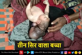 मैनपुरी में महिला ने 3 सिर वाले बच्चे को दिया जन्म