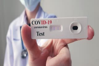 fake RT-PCR test report