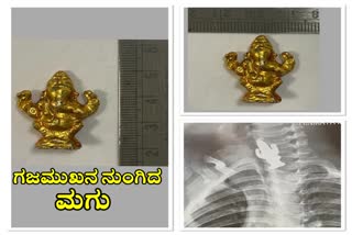 three-year-old-boy-swallowed-a-ganesh-idol-while-playing