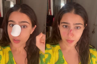 Sara Ali Khan shares video of nose injury, says 'Naak kaat di maine'