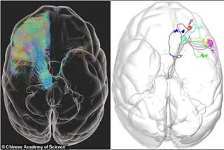 first 3D image of monkey brain, VISoR