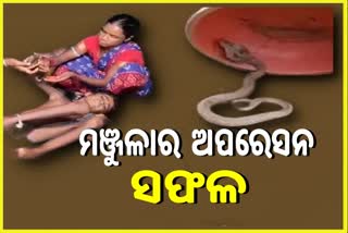 ମଞ୍ଜୁଳାଙ୍କ ପ୍ଲାଷ୍ଟିକ ସର୍ଜରି ଅସ୍ତ୍ରୋପଚାର ସଫଳ