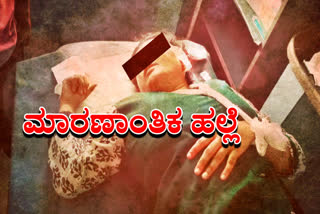 Deadly attack on daughter in law in Davanagere