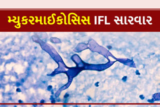 મ્યુકરમાઇકોસિસની અસરથી પીડાતા દર્દીઓને IFL સારવાર