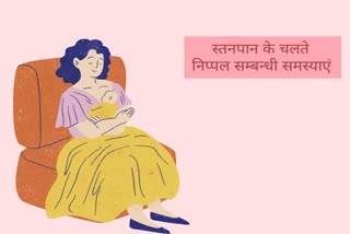 breast, nipples, cracked nipples, breastfeeding, घी, दूध, शहद, स्तनपान,  निपल्स में  दरारें