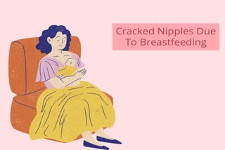 female health, women's health, breastfeeding, nipples, cracked nipples, lactating mothers, mothers, post partum