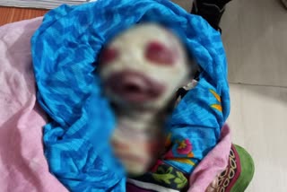 Alien birth in Sahibganj